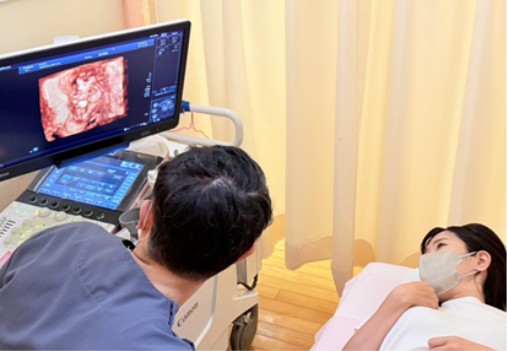 4Dエコー検査の様子